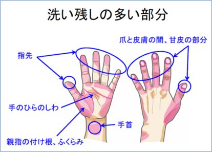 手洗いの洗い残しが多い部分